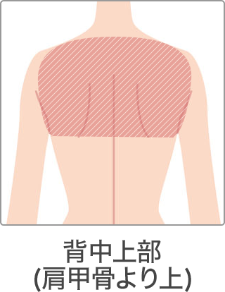 脱毛 部位 背中上部