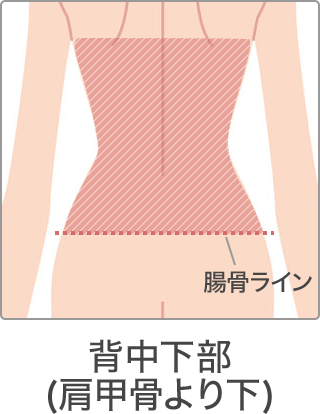 脱毛 部位 背中下部