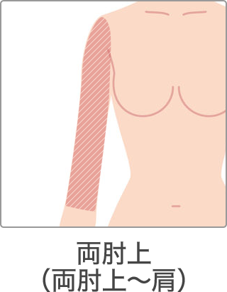 脱毛 部位 両肘上