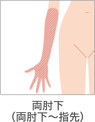 脱毛 部位 両肘下
