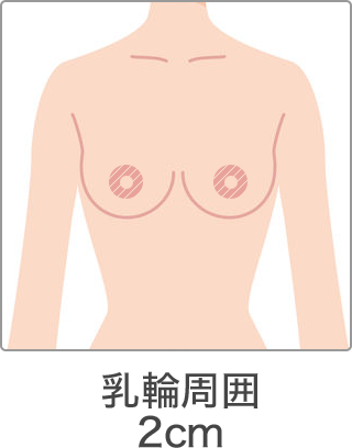 脱毛 部位 乳輪周囲