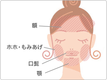 脱毛 部位 顔