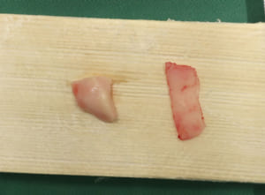 採取した耳介軟骨と鼻中隔軟骨