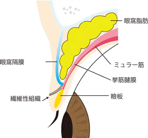 二重ができる仕組み