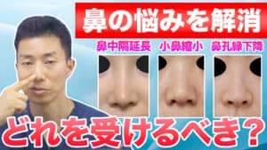 【鼻整形】鼻中隔延長と小鼻縮小と鼻孔縁下降を徹底比較｜自分はどれを受けるべき？