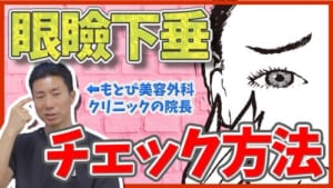 自分が眼瞼下垂かどうかをチェックする方法を解説縮小版