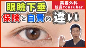 眼瞼下垂の保険適用と自費診療の適応や効果の違い