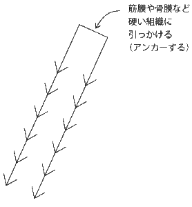 糸リフト　アンカータイプ　糸力図