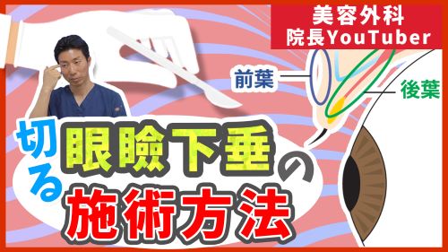 切る眼瞼下垂の施術方法とメリット・デメリットや注意点について解説